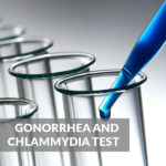 Gonorrhea and Chlammydia Test